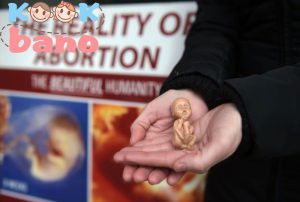 تاریخچه سقط جنین: