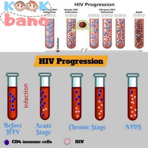 آزمایش HIV: