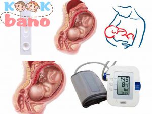 چه چیزی باعث فشار خون بالا در دوران بارداری می شود؟